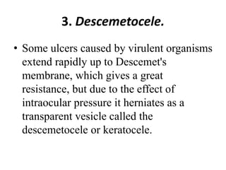 3. Descemetocele.
• Some ulcers caused by virulent organisms
extend rapidly up to Descemet's
membrane, which gives a great
resistance, but due to the effect of
intraocular pressure it herniates as a
transparent vesicle called the
descemetocele or keratocele.
 