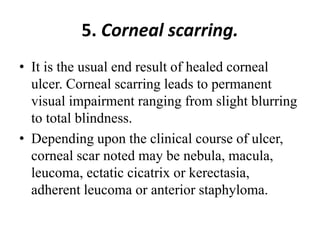 5. Corneal scarring.
• It is the usual end result of healed corneal
ulcer. Corneal scarring leads to permanent
visual impairment ranging from slight blurring
to total blindness.
• Depending upon the clinical course of ulcer,
corneal scar noted may be nebula, macula,
leucoma, ectatic cicatrix or kerectasia,
adherent leucoma or anterior staphyloma.
 