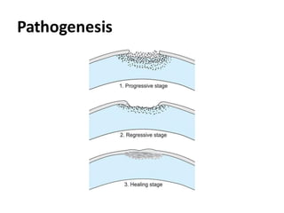 Pathogenesis
 