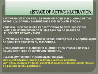 ACTIVE ULCERATION RESULTS FROM NECROSIS & SLOUGHING OF THE
EPITHELIUM, BOWMAN’S MEMBRANE & THE INVOLVED STROMA.
THE WALLS OF THE ULCER PROJECT OWING TO SWELLING OF THE
LAMELLAE BY IMBIBITION OF FLUID & PACKING OF MASSES OF
LEUCOCYTES BETWEEN THEM.
HYPEREMIA OF CIRCUMCORNEAL VESSELS RESULTING IN ACCUMULATION
OF PURULENT EXUDATES ON THE CORNEA.
EXUDATION INTO THE ANTERIOR CHAMBER FROM VESSELS OF IRIS &
CILIARY BODY LEAD TO HYPOPYON FORMATION.
ULCER MAY FURTHER PROGRESS AS FOLLOWS:
By lateral extension resulting in diffuse superficial ulceration
Or it may progress by deeper penetration leading to decemetocoele fomation
& a possible corneal perforation.
 