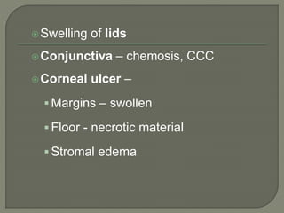Swelling of lids
Conjunctiva – chemosis, CCC
Corneal ulcer –
 Margins – swollen
 Floor - necrotic material
 Stromal edema
 