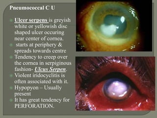 Pneumococcal C U
 Ulcer serpens is greyish
white or yellowish disc
shaped ulcer occuring
near center of cornea.
 starts at periphery &
spreads towards centre
 Tendency to creep over
the cornea in serpiginous
fashion- Ulcus Serpen.
 Violent iridocyclitis is
often associated with it.
 Hypopyon – Usually
present
 It has great tendency for
PERFORATION.
 