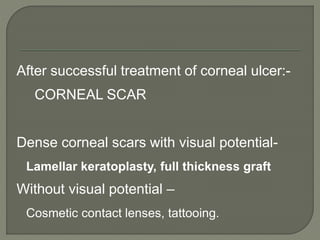 After successful treatment of corneal ulcer:-
CORNEAL SCAR
Dense corneal scars with visual potential-
Lamellar keratoplasty, full thickness graft
Without visual potential –
Cosmetic contact lenses, tattooing.
 