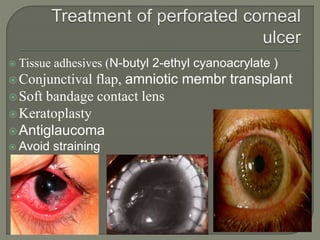  Tissue adhesives (N-butyl 2-ethyl cyanoacrylate )
Conjunctival flap, amniotic membr transplant
Soft bandage contact lens
Keratoplasty
Antiglaucoma
 Avoid straining
 