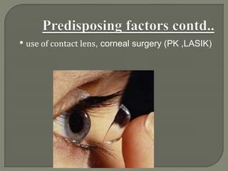 • use of contact lens, corneal surgery (PK ,LASIK)
 