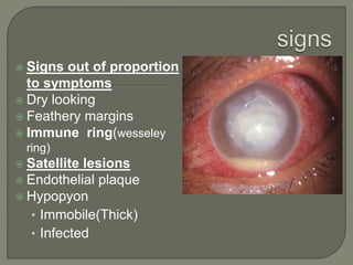  Signs out of proportion
to symptoms
 Dry looking
 Feathery margins
 Immune ring(wesseley
ring)
 Satellite lesions
 Endothelial plaque
 Hypopyon
• Immobile(Thick)
• Infected
 