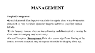 MANAGEMENT
Surgical Management:
•Eyelash Removal: If an ingrown eyelash is causing the ulcer, it may be removed
along with its root. Recurrent cases may require electrolysis to destroy the hair
follicle.
•Eyelid Surgery: In cases where an inward-turning eyelid (entropion) is causing the
ulcer, corrective surgery may be necessary.
•Corneal Transplant (Keratoplasty): If the ulcer causes significant thinning of the
cornea, a corneal transplant may be required to restore the integrity of the eye.
 
