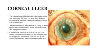 CORNEAL ULCER
• The cornea is useful in focusing light on the retina
and protecting the inner eye structures. Corneal
ulcers can be a serious condition leading to vision
loss if not treated.
• A Cornea ulcer will often appear as a grey to white
opaque or translucent area on the normally clear
and transparent cornea.
• Cornea is the structure in front of the eye. The
cornea overlies the iris which is the coloured part
of the eye and is separated from the iris by the
aqueous fluid in the anterior chamber of the eye.
 