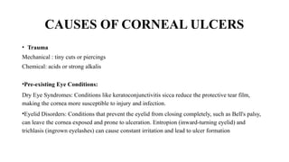 CAUSES OF CORNEAL ULCERS
• Trauma
Mechanical : tiny cuts or piercings
Chemical: acids or strong alkalis
•Pre-existing Eye Conditions:
Dry Eye Syndromes: Conditions like keratoconjunctivitis sicca reduce the protective tear film,
making the cornea more susceptible to injury and infection.
•Eyelid Disorders: Conditions that prevent the eyelid from closing completely, such as Bell's palsy,
can leave the cornea exposed and prone to ulceration. Entropion (inward-turning eyelid) and
trichlasis (ingrown eyelashes) can cause constant irritation and lead to ulcer formation
 
