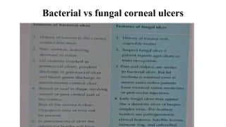 Bacterial vs fungal corneal ulcers
 