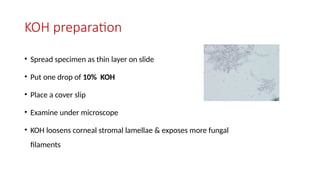 Koh Tablet Method Corneal Ulcer with approach simplified.pptx