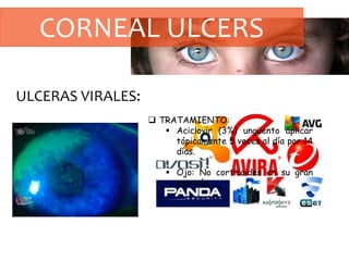 CORNEAL ULCERS
ULCERAS VIRALES:
 TRATAMIENTO:
 Aciclovir (3%) ungüento aplicar
tópicamente 5 veces al día por 14
días.
 Ojo: No corticoides en su gran
mayoría.
 