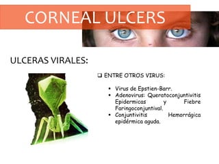 CORNEAL ULCERS
ULCERAS VIRALES:
 ENTRE OTROS VIRUS:
 Virus de Epstien-Barr.
 Adenovirus: Queratoconjuntivitis
Epidermicas y Fiebre
Faringoconjuntival.
 Conjuntivitis Hemorrágica
epidérmica aguda.
 