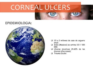 CORNEAL ULCERS
EPIDEMIOLOGIA:
 1.5 a 2 millones de caso de ceguera
anual.
 India (Madurai) se estima 113 / 100
000.
 Ulceras micoticas (4-60% de las
úlceras infecciosas).
 Trauma Ocular.
 