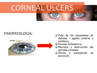 CORNEAL ULCERS
FISIOPATOLOGIA:  Falla de los mecanismos de
defensa + agente externo o
sistémico.
 Proceso inflamatorio.
 Necrosis y destrucción del
estroma corneano.
 Úlcera y acumulación de
secreción.
 