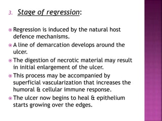 3. Stage of regression:
 Regression is induced by the natural host
defence mechanisms.
 A line of demarcation develops around the
ulcer.
 The digestion of necrotic material may result
in initial enlargement of the ulcer.
 This process may be accompanied by
superficial vascularization that increases the
humoral & cellular immune response.
 The ulcer now begins to heal & epithelium
starts growing over the edges.
 