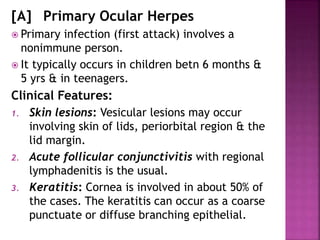 [A] Primary Ocular Herpes
 Primary infection (first attack) involves a
nonimmune person.
 It typically occurs in children betn 6 months &
5 yrs & in teenagers.
Clinical Features:
1. Skin lesions: Vesicular lesions may occur
involving skin of lids, periorbital region & the
lid margin.
2. Acute follicular conjunctivitis with regional
lymphadenitis is the usual.
3. Keratitis: Cornea is involved in about 50% of
the cases. The keratitis can occur as a coarse
punctuate or diffuse branching epithelial.
 