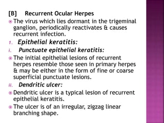 [B] Recurrent Ocular Herpes
 The virus which lies dormant in the trigeminal
ganglion, periodically reactivates & causes
recurrent infection.
1. Epithelial keratitis:
i. Punctuate epithelial keratitis:
 The initial epithelial lesions of recurrent
herpes resemble those seen in primary herpes
& may be either in the form of fine or coarse
superficial punctuate lesions.
ii. Dendritic ulcer:
 Dendritic ulcer is a typical lesion of recurrent
epithelial keratitis.
 The ulcer is of an irregular, zigzag linear
branching shape.
 
