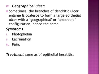 iii. Geographical ulcer:
 Sometimes, the branches of dendritic ulcer
enlarge & coalesce to form a large epithelial
ulcer with a ‘geographical’ or ‘amoeboid’
configuration, hence the name.
Symptoms
i. Photophobia
ii. Lacrimation
iii. Pain.
Treatment same as of epithelial keratitis.
 