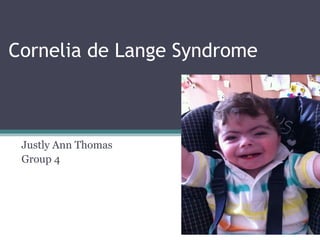 Cornelia de Lange Syndrome
Justly Ann Thomas
Group 4
 