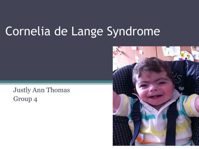 Cornelia de Lange Syndrome.pptx