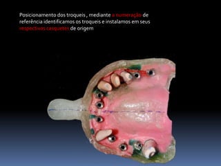Posicionamento dos troqueis , mediante a numeração de
referência identificamos os troqueis e instalamos em seus
respectivos casquetes de origem
 