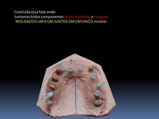 Concluída essa fase onde:
Juntamos todos componentes sobre implantes e troqueis
 MOLDADOS UM A UM JUNTOS EM UM ÚNICO modelo
 