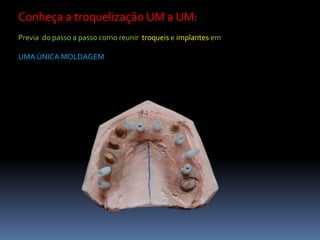 Conheça a troquelização UM a UM:
Previa do passo a passo como reunir troqueis e implantes em

UMA ÚNICA MOLDAGEM
 