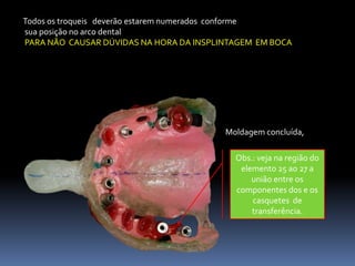 Todos os troqueis deverão estarem numerados conforme
sua posição no arco dental
PARA NÃO CAUSAR DÚVIDAS NA HORA DA INSPLINTAGEM EM BOCA




                                         Moldagem concluída,

                                           Obs.: veja na região do
                                            elemento 25 ao 27 a
                                               união entre os
                                           componentes dos e os
                                               casquetes de
                                               transferência.
 