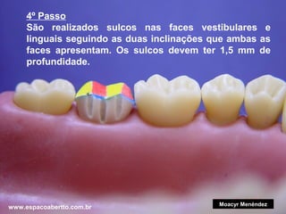 4º Passo
São realizados sulcos nas faces vestibulares e
linguais seguindo as duas inclinações que ambas as
faces apresentam. Os sulcos devem ter 1,5 mm de
profundidade.

www.espacoabertto.com.br

Moacyr Menéndez

 