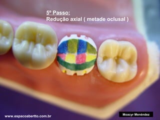 5º Passo:
Redução axial ( metade oclusal )

www.espacoabertto.com.br

Moacyr Menéndez

 