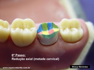 6º Passo:
Redução axial (metade cervical)
www.espacoabertto.com.br

Moacyr Menéndez

 