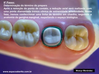 8º Passo:
Determinação do término do preparo
Após a remoção do ponto de contato, a redução axial será realizada com
uma ponta diamantada tronco cônica de extremidade arredondada. Nesta
fase, iremos confeccionar uma linha de término em chanfro, seguindo a
anatomia da gengiva marginal, respeitando o espaço biológico

www.espacoabertto.com.br

Moacyr Menéndez

 