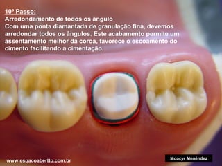 10º Passo:
Arredondamento de todos os ângulo
Com uma ponta diamantada de granulação fina, devemos
arredondar todos os ângulos. Este acabamento permite um
assentamento melhor da coroa, favorece o escoamento do
cimento facilitando a cimentação.

www.espacoabertto.com.br

Moacyr Menéndez

 