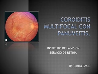 INSTITUTO DE LA VISION
SERVICIO DE RETINA
Dr. Carlos Grau.
 