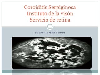 2 2 N O V I E M B R E 2 0 1 0
Coroiditis Serpiginosa
Instituto de la visón
Servicio de retina
 