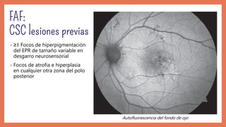 • ≥1 Focos de hiperpigmentación
del EPR de tamaño variable en
desgarro neurosensorial
• Focos de atrofia e hiperplasia
en cualquier otra zona del polo
posterior
Autofluorescencia del fondo de ojo
 