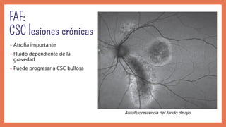 • Atrofia importante
• Fluido dependiente de la
gravedad
• Puede progresar a CSC bullosa
Autofluorescencia del fondo de ojo
 