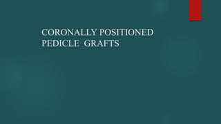 CORONALLY POSITIONED
PEDICLE GRAFTS
 