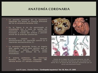 Visión de la base (a) y la cara anterior (b) del
corazón en posición anatómica que se muestra la
aorta (A) y el curso de las arterias coronarias por el
surco auriculove nt r icu l a r.
 La porción proximal de la coronaria
izquierda (CI) posee un trayecto diferente
del de la coronaria derecha (CD).
 En la figura b se ha seccionado el
infundíbulo (In) o cono de salida del
ventrículo derecho. c-f: secciones
frontales a través del orificio y porción
inicial de la arterias coronarias:
 Derecha control (c), derecha
aterosclerótica (d), izquierda control (e) e
izquierda aterosclerótica (f).
 La coronaria izquierda forma un ángulo
más agudo con el seno aórtico que la
derecha y ambos orificios están
localizados por debajo de la unión
sinutubular.
 P: arteria pulmonar; VD: ventrículo
derecho; VI: ventrículo izquierdo; VM:
válvula mitral; V T: válvula tricúspide.
ANATOMÍA CORONARIA
José R López, Vicente Climen , “Cardiopatía isquémica” Vol. 59, Núm. 07, 2006
 
