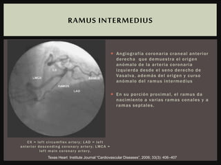 CX = lef t circumflex artery; LAD = lef t
anterior descending coronary artery; LMCA =
lef t main coronary artery.
 Angiografía coronaria craneal anterior
derecha que demuestra el origen
anómalo de la arteria coronaria
izquierda desde el seno derecho de
Vasalva, además del origen y curso
anómalo del ramus intermedius
 En su porción proximal, el ramus da
nacimiento a varias ramas conales y a
ramas septales.
RAMUS INTERMEDIUS
Texas Heart Institute Journal “Cardiovascular Diseases”, 2006; 33(3): 406–407
 