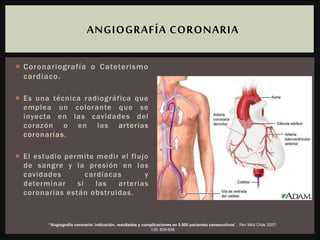  Coronariografía o Cateterismo
cardiaco.
 Es una técnica radiográfica que
emplea un colorante que se
inyecta en las cavidades del
corazón o en las arterias
coronarias.
 El estudio permite medir el flujo
de sangre y la presión en las
cavidades cardíacas y
determinar si las arterias
coronarias están obstruidas.
ANGIOGRAFÍA CORONARIA
“Angiografía coronaria: indicación, resultados y complicaciones en 5.000 pacientes consecutivos”, Rev Méd Chile 2007;
135: 829-838
 