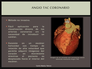 Imagen de un corazón con coronarias sanas
obtenida mediante Angio TAC
 Método no invasivo.
 Fácil aplicación para la
visualización directa de las
arterias coronarias sin la
necesidad de introducir un
catéter.
 Consiste en un escáner
helicoidal con tiempo de
rotación de alta velocidad que
permite adquirir imágenes del
corazón en movimiento
mientras el paciente es
desplazado hacia el interior del
escáner.
ANGIO TAC CORONARIO
Centro Medico Teknon
 