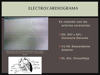 Afectación de Coronaria Derecha (DII y DIII),
descendente anterior (V2, V3) y circunfleja
(AVL).
En relación con las
arterias coronarias:
 DII, DIII y AVL:
Coronaria Derecha
 V1-V6: Descendente
Anterior
 DI, AVL: Circunfleja
ELECTROCARDIOGRAMA
 