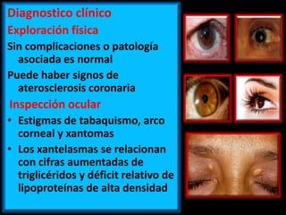 Diagnostico clínico
Exploración física
Sin complicaciones o patología
asociada es normal
Puede haber signos de
aterosclerosis coronaria

Inspección ocular
• Estigmas de tabaquismo, arco
corneal y xantomas
• Los xantelasmas se relacionan
con cifras aumentadas de
triglicéridos y déficit relativo de
lipoproteínas de alta densidad

 
