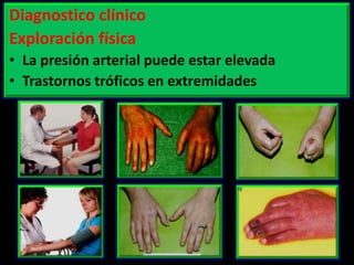 Diagnostico clínico
Exploración física
• La presión arterial puede estar elevada
• Trastornos tróficos en extremidades

 