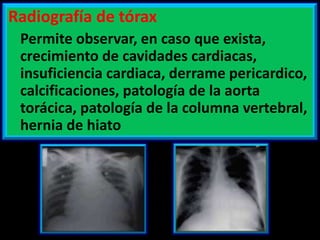 Radiografía de tórax
Permite observar, en caso que exista,
crecimiento de cavidades cardiacas,
insuficiencia cardiaca, derrame pericardico,
calcificaciones, patología de la aorta
torácica, patología de la columna vertebral,
hernia de hiato

 