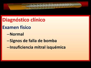 Diagnóstico clínico
Examen físico
–Normal
–Signos de falla de bomba
–Insuficiencia mitral isquémica

 