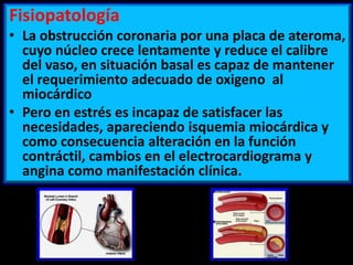 Fisiopatología
• La obstrucción coronaria por una placa de ateroma,
cuyo núcleo crece lentamente y reduce el calibre
del vaso, en situación basal es capaz de mantener
el requerimiento adecuado de oxigeno al
miocárdico
• Pero en estrés es incapaz de satisfacer las
necesidades, apareciendo isquemia miocárdica y
como consecuencia alteración en la función
contráctil, cambios en el electrocardiograma y
angina como manifestación clínica.

 