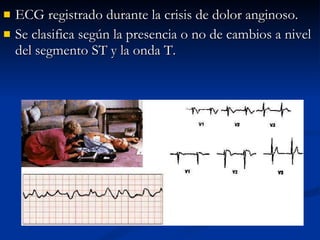ECG registrado durante la crisis de dolor anginoso.  Se clasifica según la presencia o no de cambios a nivel del segmento ST y la onda T. 